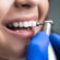 How much is a teeth cleaning
